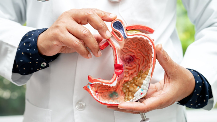 Thumbnail of Stomach Pain: A Sign of Cancer? Effective Treatment Options for Late Stage