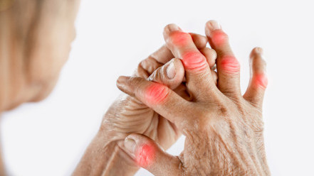 Thumbnail of Wrist and Hand Osteoarthritis: Symptoms, Types and Treatments