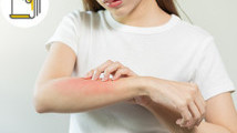 Thumbnail of 4 Tips of Combating Eczema and Dust Mite Allergy