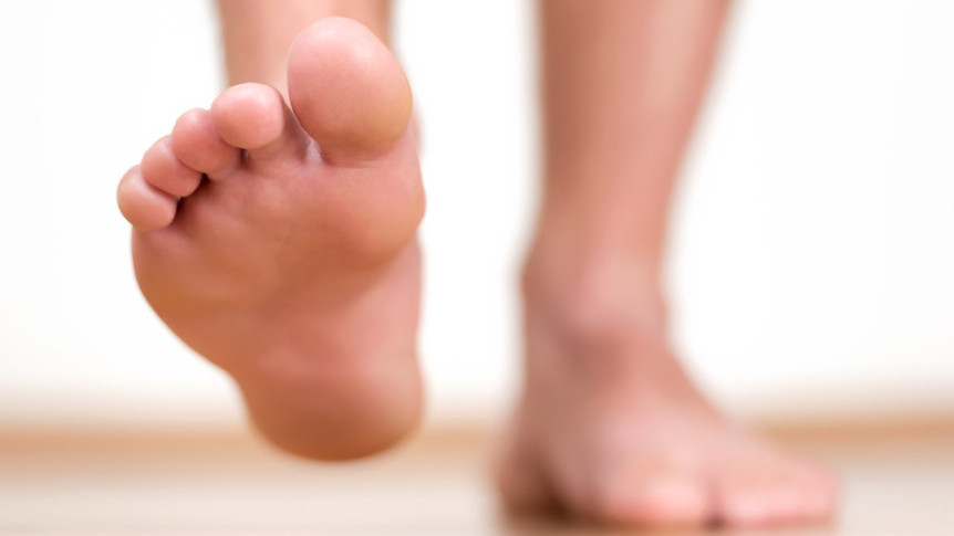 缩图 - 拆解夏天常见足部陷阱：5类人易有香港脚？穿人字拖或致足底筋膜炎？