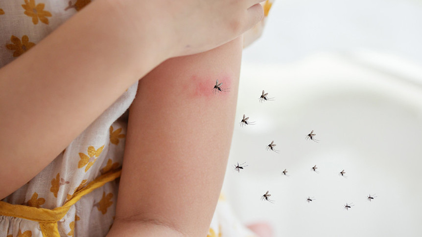 Thumbnail of Will Dengue Fever Become Severe after Secondary Infection? Will DEET Mosquito Repellent Affect Children's Health? Doctor's Advices to Effectively Repel Mosquitoes