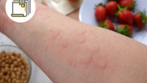 缩图 - 食物过敏:由戒口到预防