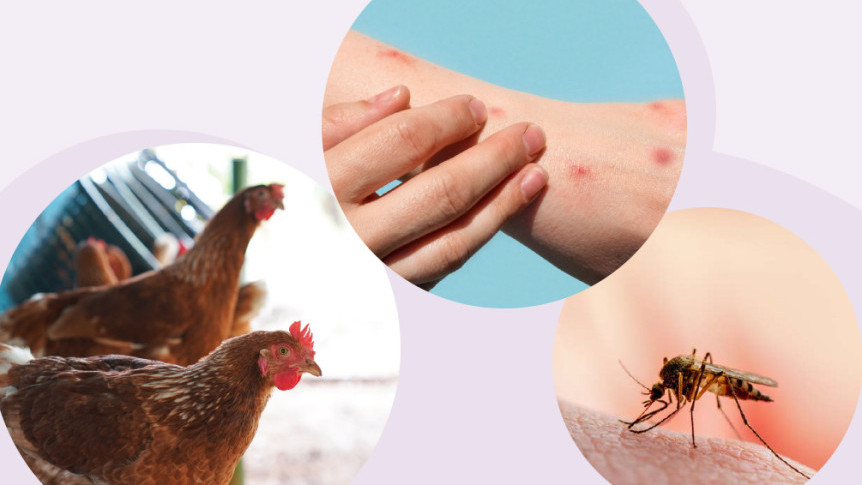 Thumbnail of Not Just COVID-19: Protect Yourself from Avian Influenza, Monkeypox and Dengue Fever during Travel