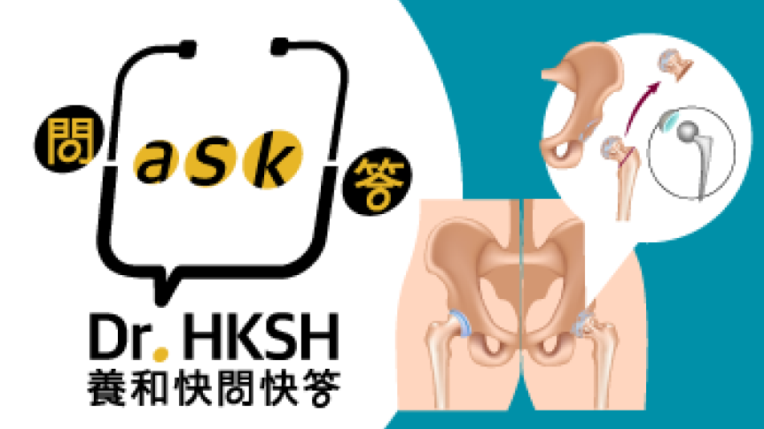 缩图 - 《养和快问快答》认识髋关节置换术，安心更换麒麟骹