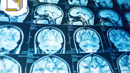 Thumbnail of Personalised Treatment - The Evolution of Diagnostic And Interventional Radiology