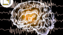 Thumbnail of Epilepsy and Seizure