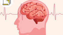 Thumbnail of Stay Alert of Stroke with “FAST”