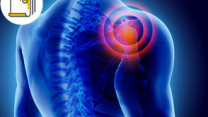 Thumbnail of 4 Common Types of Bursitis and Related Treatment