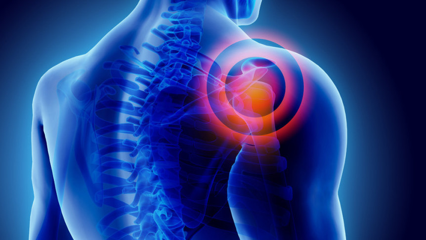 Thumbnail of 4 Common Types of Bursitis and Related Treatment