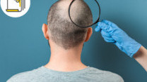 Thumbnail of Hair Loss: Types, Causes and Treatment