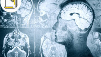 Thumbnail of Nasopharyngeal Cancer and Stroke
