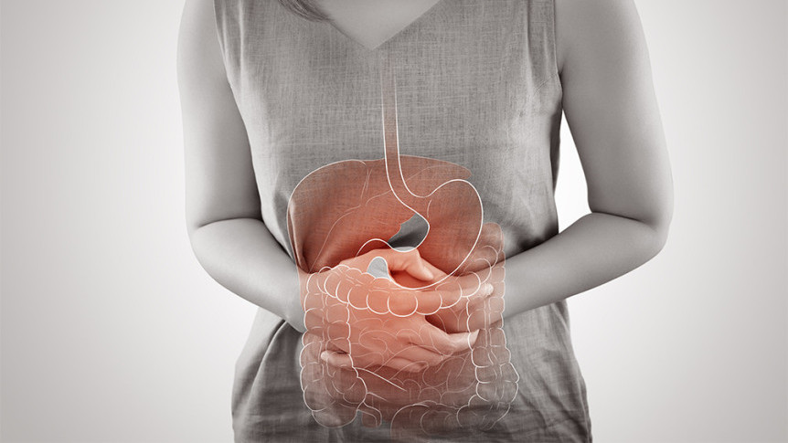 Thumbnail of Esophageal Varices: Causes, Symptoms and Treatment