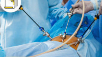 Thumbnail of Symptoms and Treatment of Acute Appendicitis