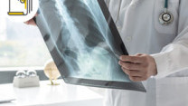 Thumbnail of Risk Factors, Symptoms and Treatment of Lung Cancer