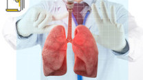 Thumbnail of Who Are at High Risk of Pneumothorax (Collapsed Lung)?