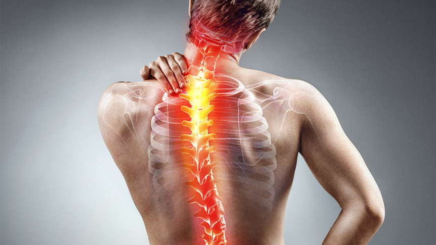 Thumbnail of Scoliosis