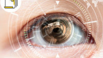Thumbnail of Distorted Vision: Vitreomacular Retinal Diseases