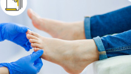 Thumbnail of Corns and Calluses