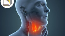 Thumbnail of Oral Cavity Cancer