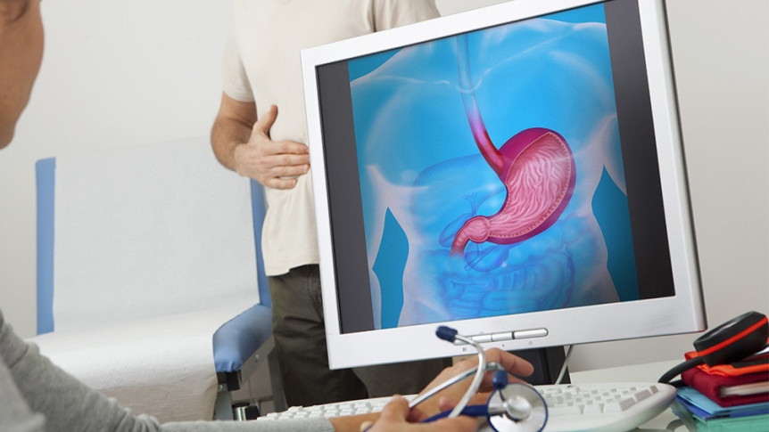 Thumbnail of Early Stage of Stomach Cancer