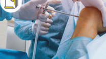 Thumbnail of Knee Replacement