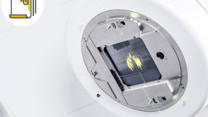 Thumbnail of Radiation Therapy for Cervical Cancer