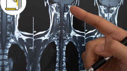 Thumbnail of Common Cancer in Men - Throat Cancer