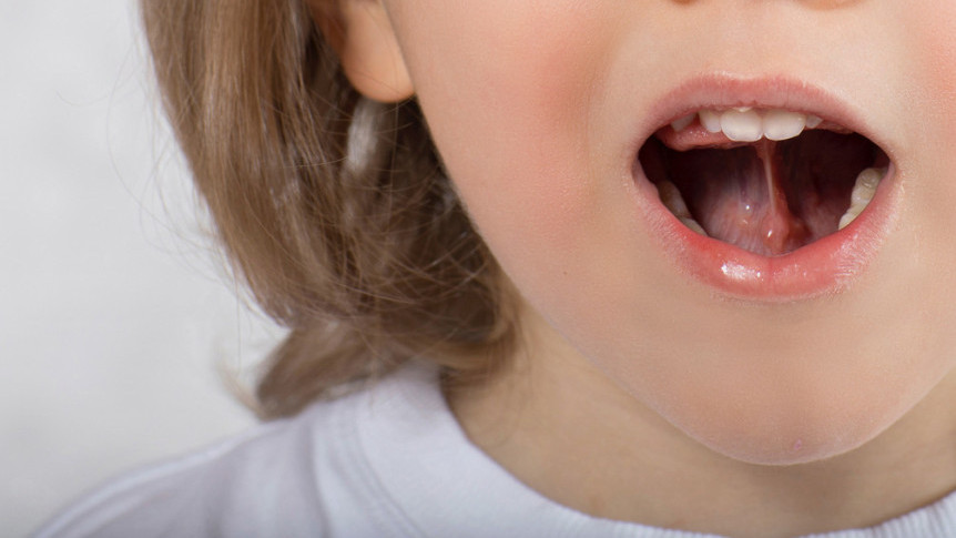 Thumbnail of Assessment of Speech and Language Development in Children
