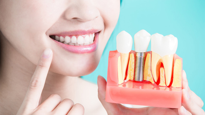 缩图 - 植齿手术 引入数码三维新技术