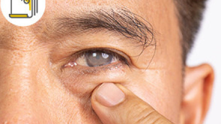 Thumbnail of Cataract Surgery: A Comprehensive Comparison of Four Types of Intraocular Lenses