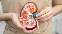 Thumbnail of Polycystic Kidney Disease: Big Cysts Can Cause Kidney Failure — Over 80% Are Inherited