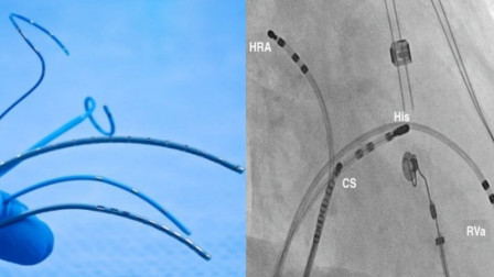 Catheters for Electrophysiology Study and Radiofrequency Ablation