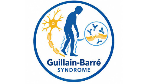 Thumbnail of Guillain-Barre Syndrome