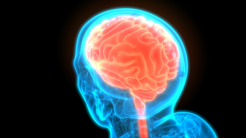 Thumbnail of Brain Tumour