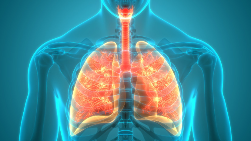Thumbnail of Lung Cancer
