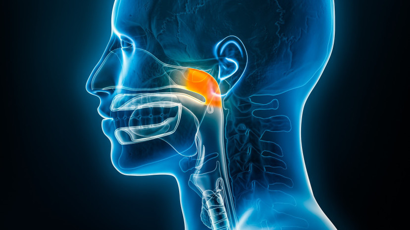 Thumbnail of Nasopharynx Cancer