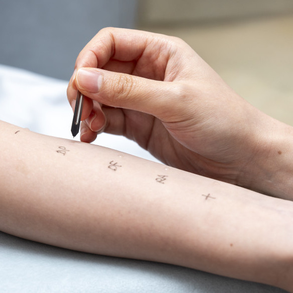 Allergy Tests and Investigations