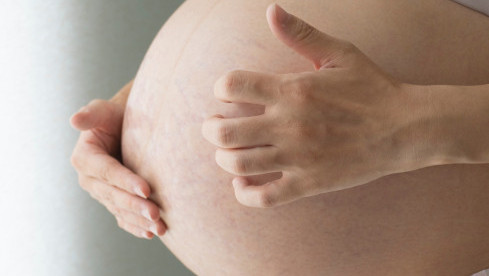 Thumbnail of Multiple Pregnancy