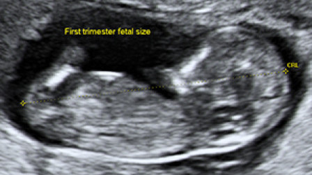 The crown-rump length of the fetus at 12 weeks