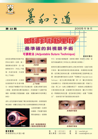 縮圖 - 《養和之道》最準確的斜視眼手術