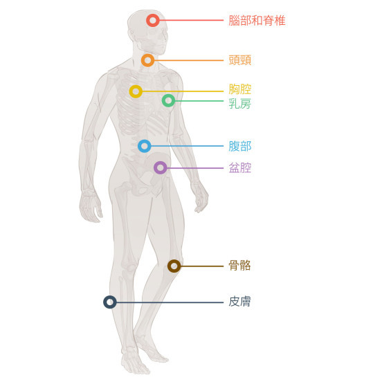 縮圖 - 癌症治療