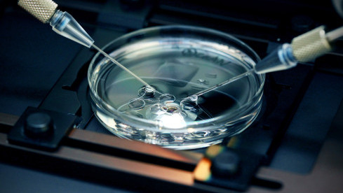 Thumbnail of IVF-ET Procedure