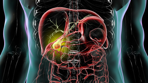 Thumbnail of Hepatobiliary & Pancreatic Surgery