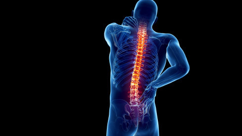 Thumbnail of Spine Problems