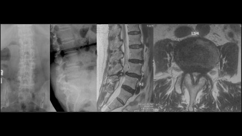 Thumbnail of Degenerative Diseases