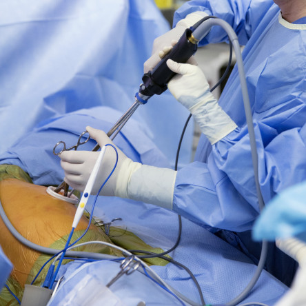 Thumbnail of Diaphragmatic Surgery
