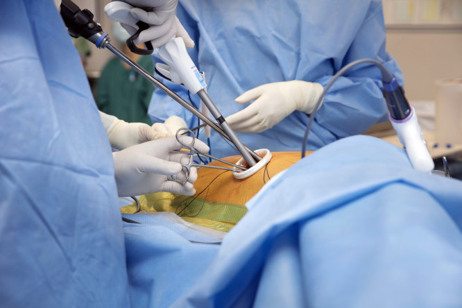 Thumbnail of Chest Wall Surgery
