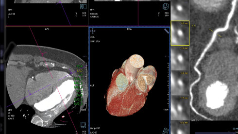 Thumbnail of Advanced Imaging Examinations