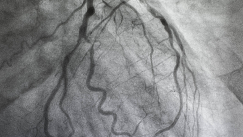 Thumbnail of Biplane All-Digital Angiography System