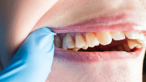 Thumbnail of Oral Pathology